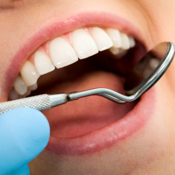 Close-up of a dental check-up. A gloved hand holds a dental mirror, inspecting the teeth and gums of a patient's open mouth.